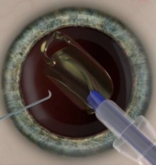 �}�������������Y�������o��